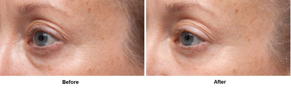 Dr Dennis Gross serum dispense close-up shows easy, precise application.