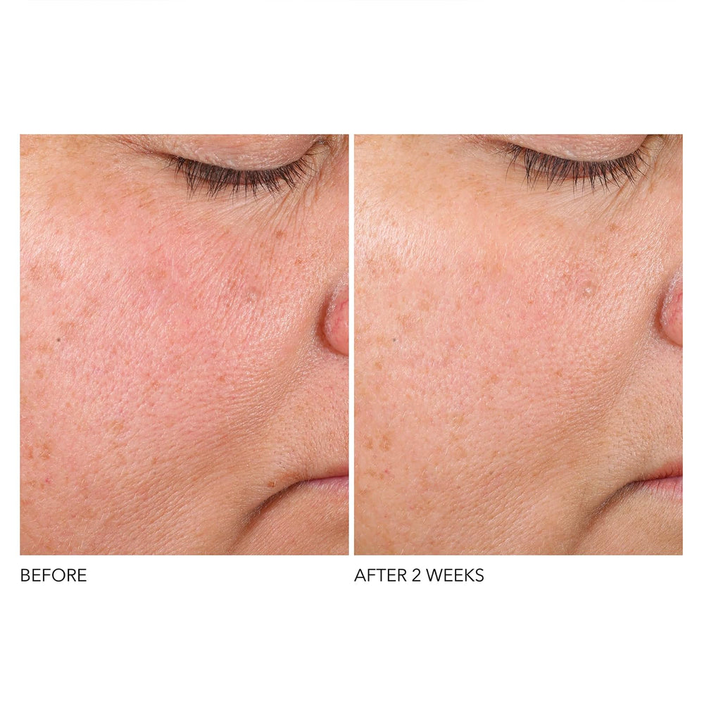 Routine shot of applying the serum in the morning and at night.