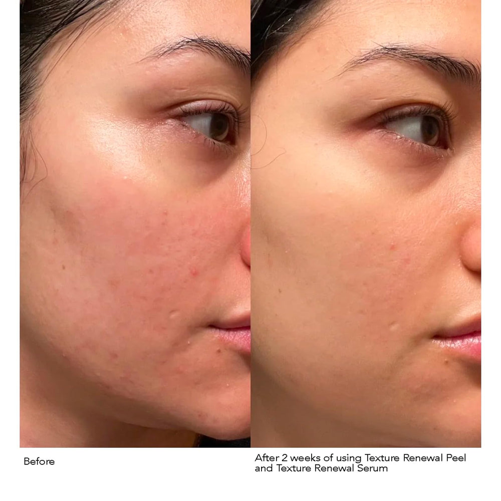 Hydration from squalane and hyaluronic acid in Dr Gross formula.