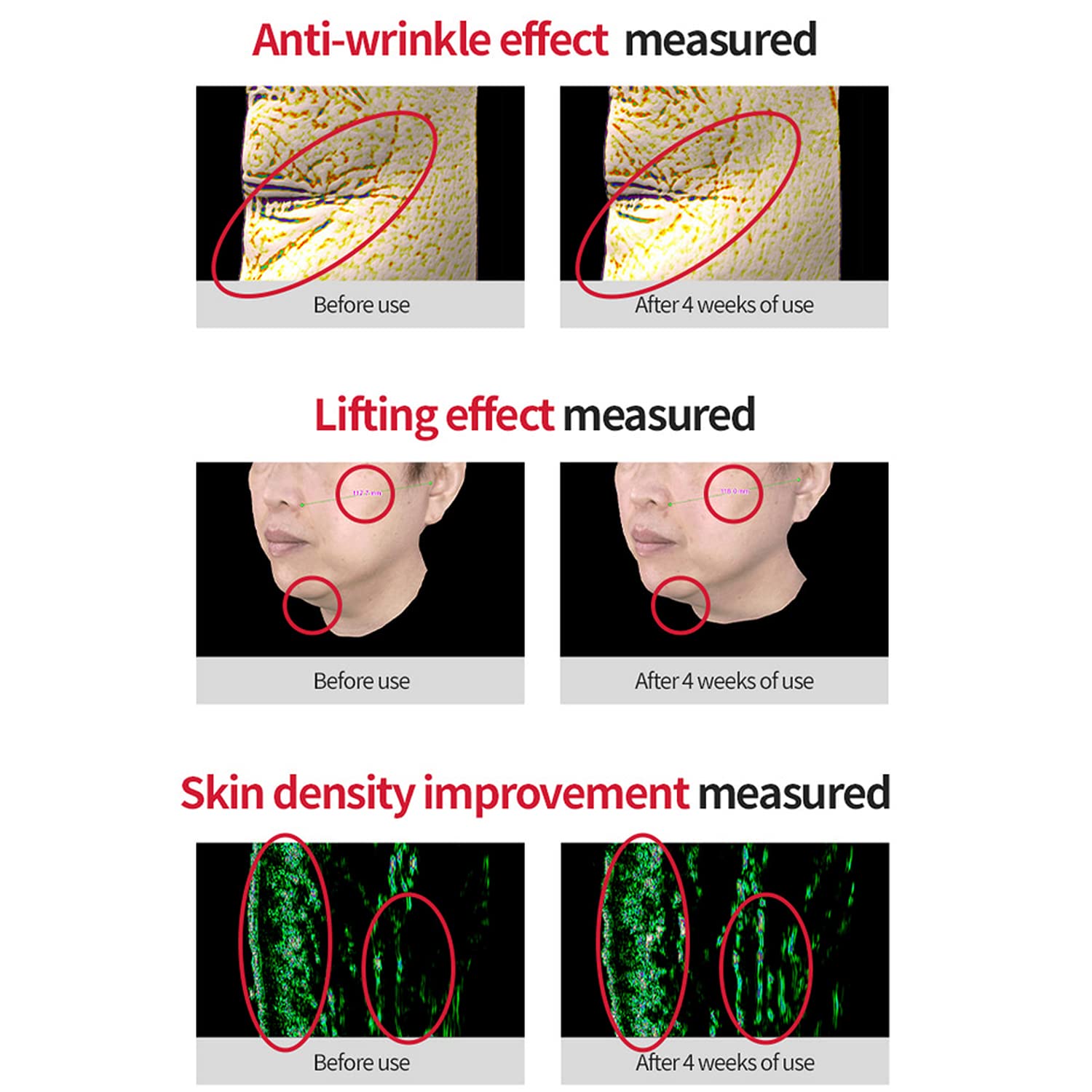 Facial application massage demonstrating lifting and smoothing action of VITALIFT-A.