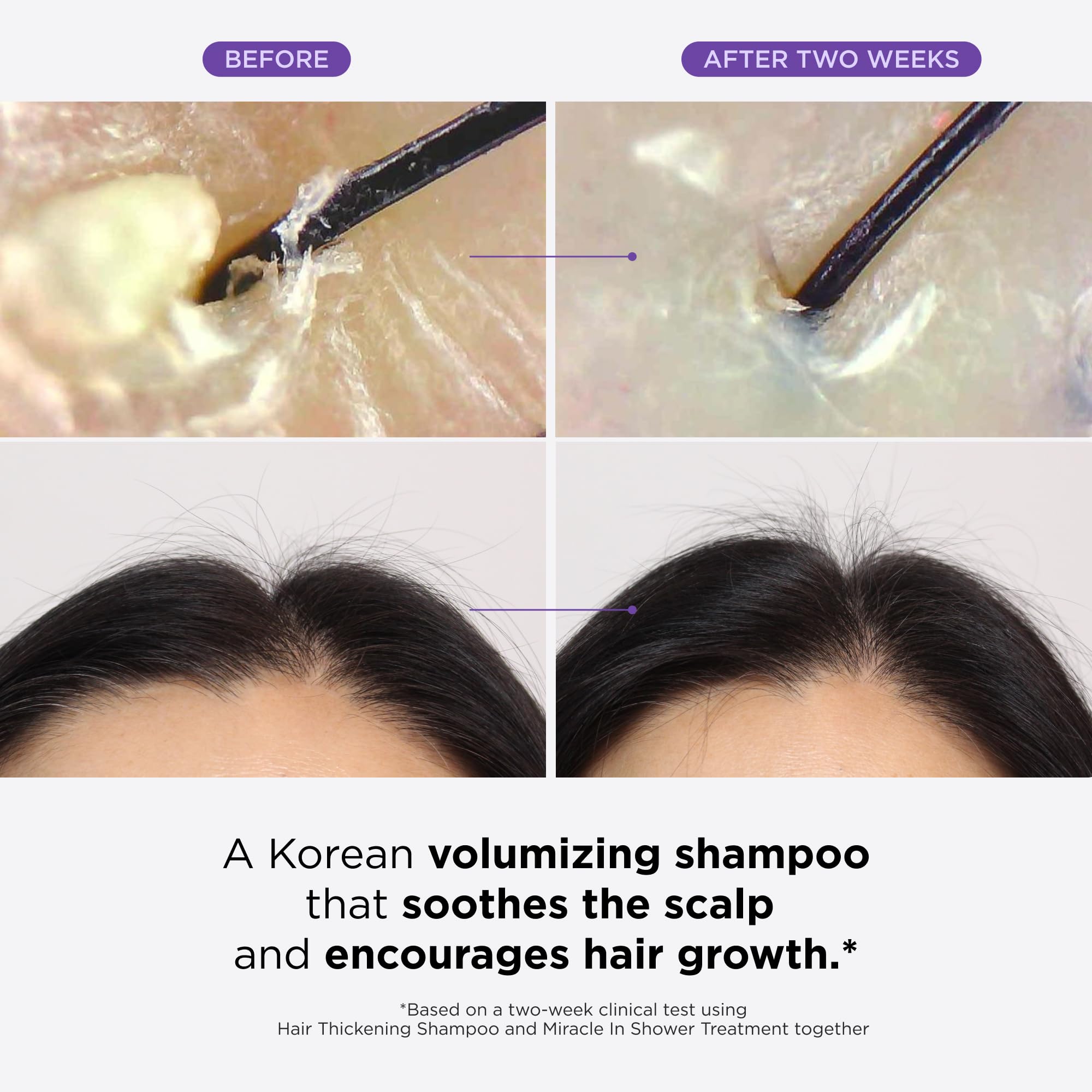 Dr. Groot Miracle in Shower Treatment exfoliates and nourishes the scalp.