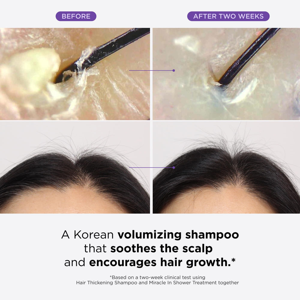 Dr. Groot Miracle in Shower Treatment exfoliates and nourishes the scalp.