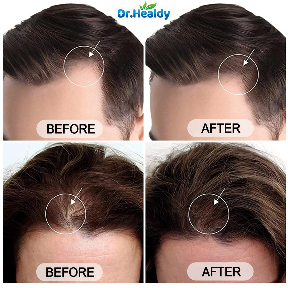 Nighttime use scene showing gentle cleansing prepping scalp for rest.