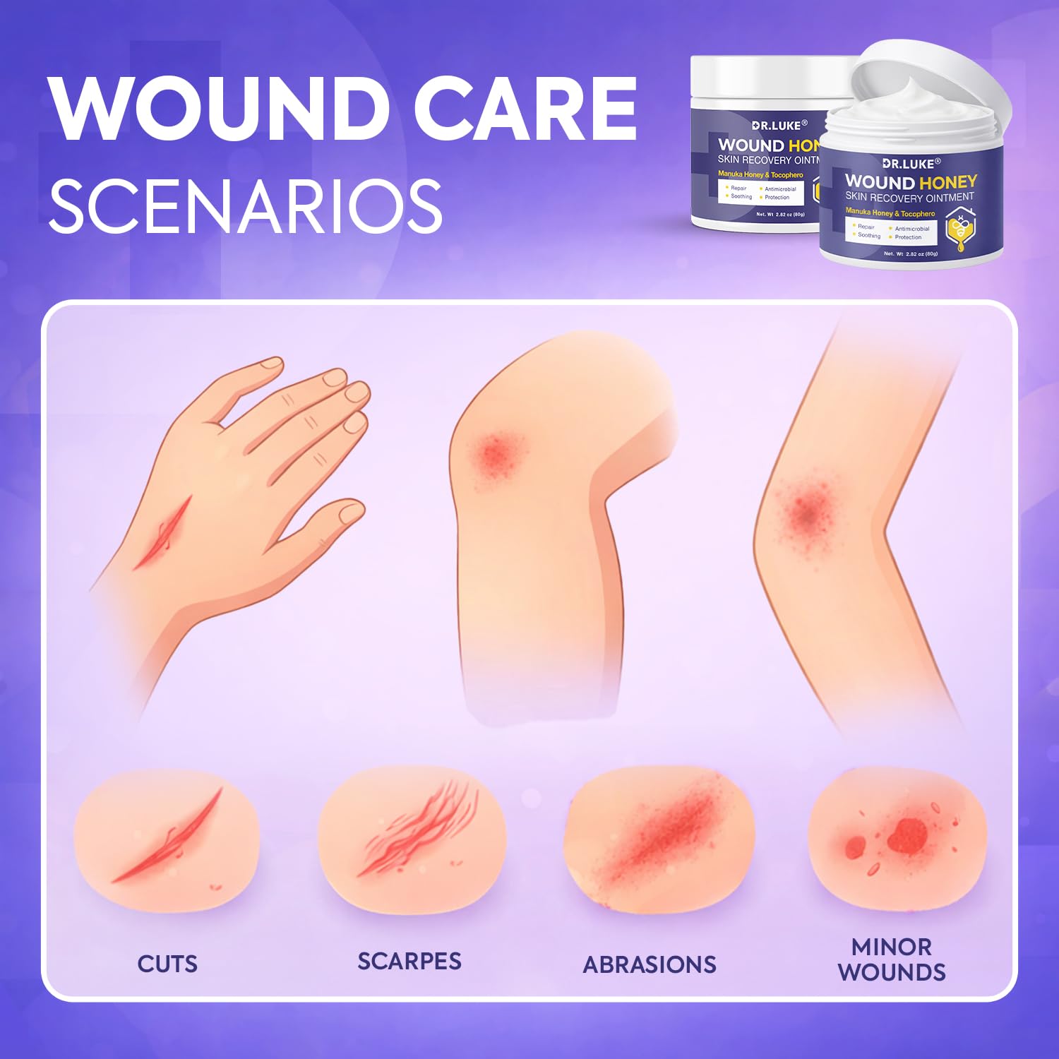 Dr. Luke Manuka Honey Wound Gel tube front detail for easy, non-greasy application.