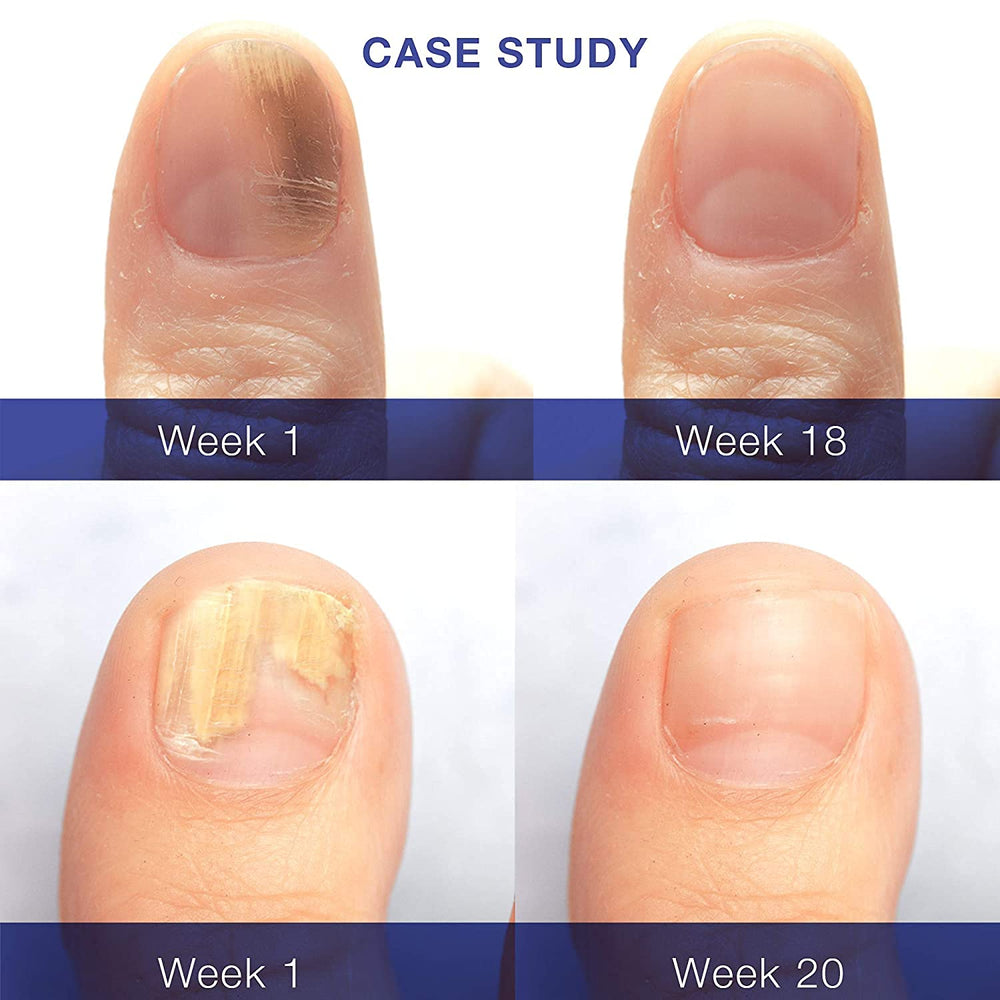 Dr. Luke Nail Repair Liquid applying on nails and cuticles for smooth look.