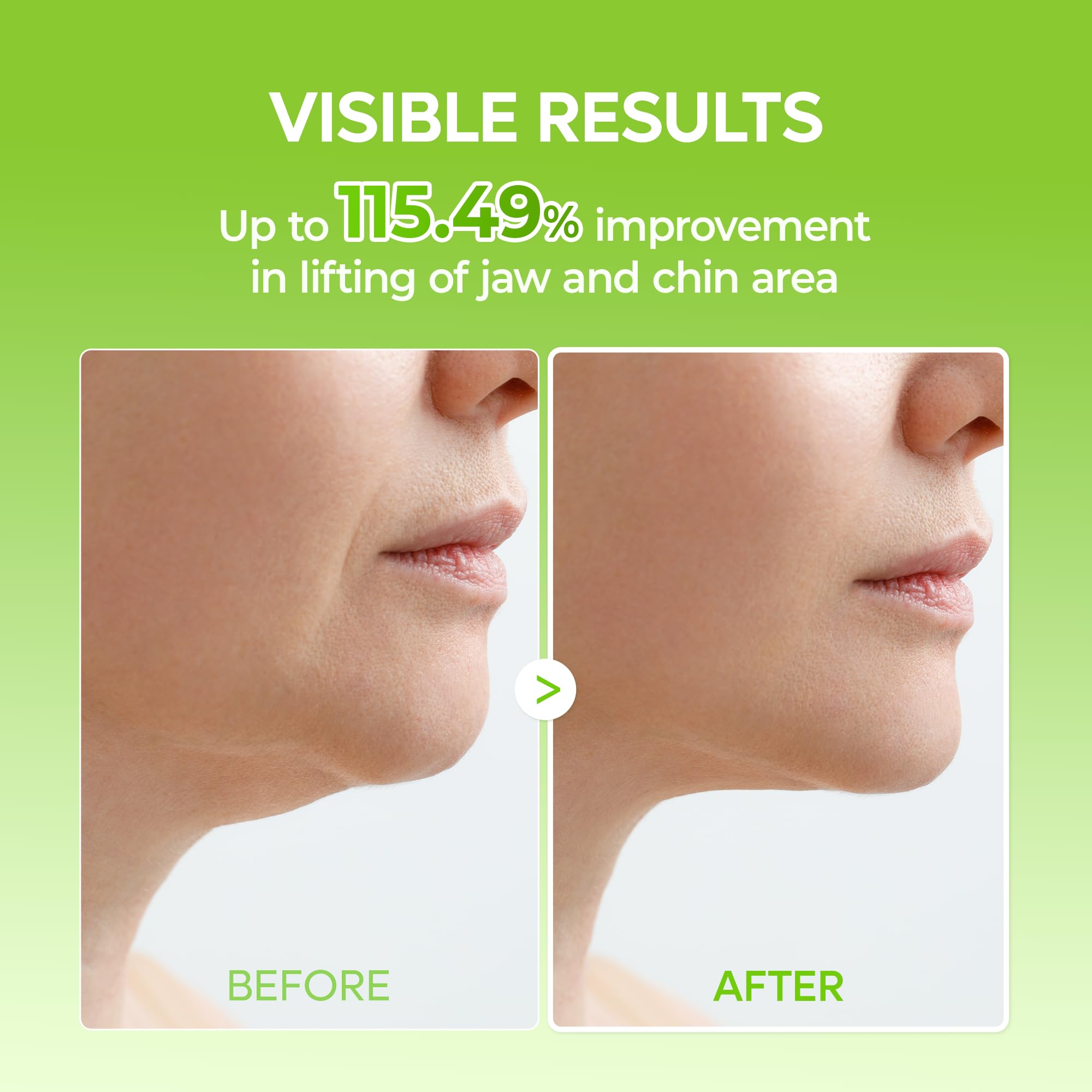 Dr.Melaxin Cactox V-Lifting Mewing Band designed for daily wear in comfort.