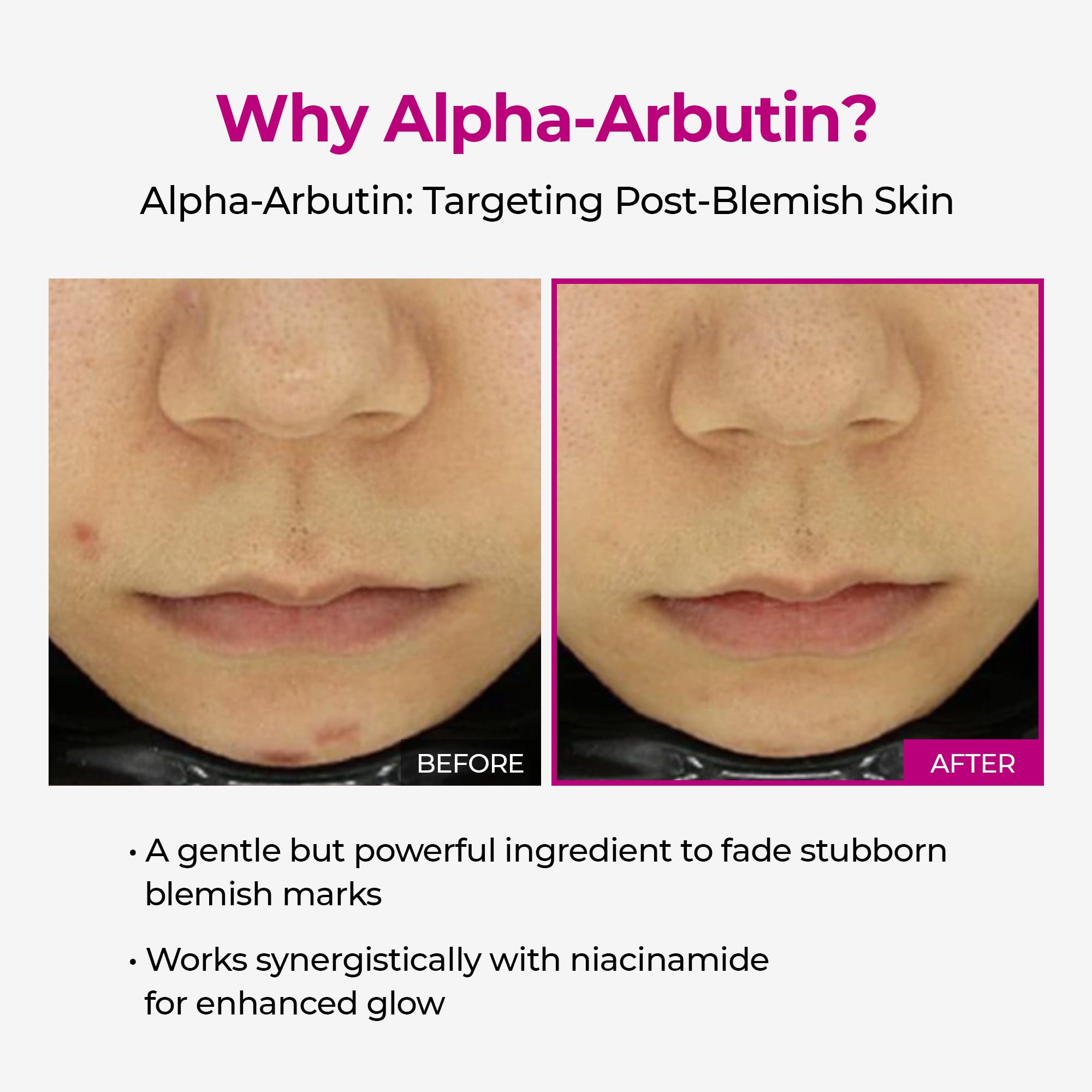 Dr.Melaxin Cemenrete Shot promotes an even tone over time.