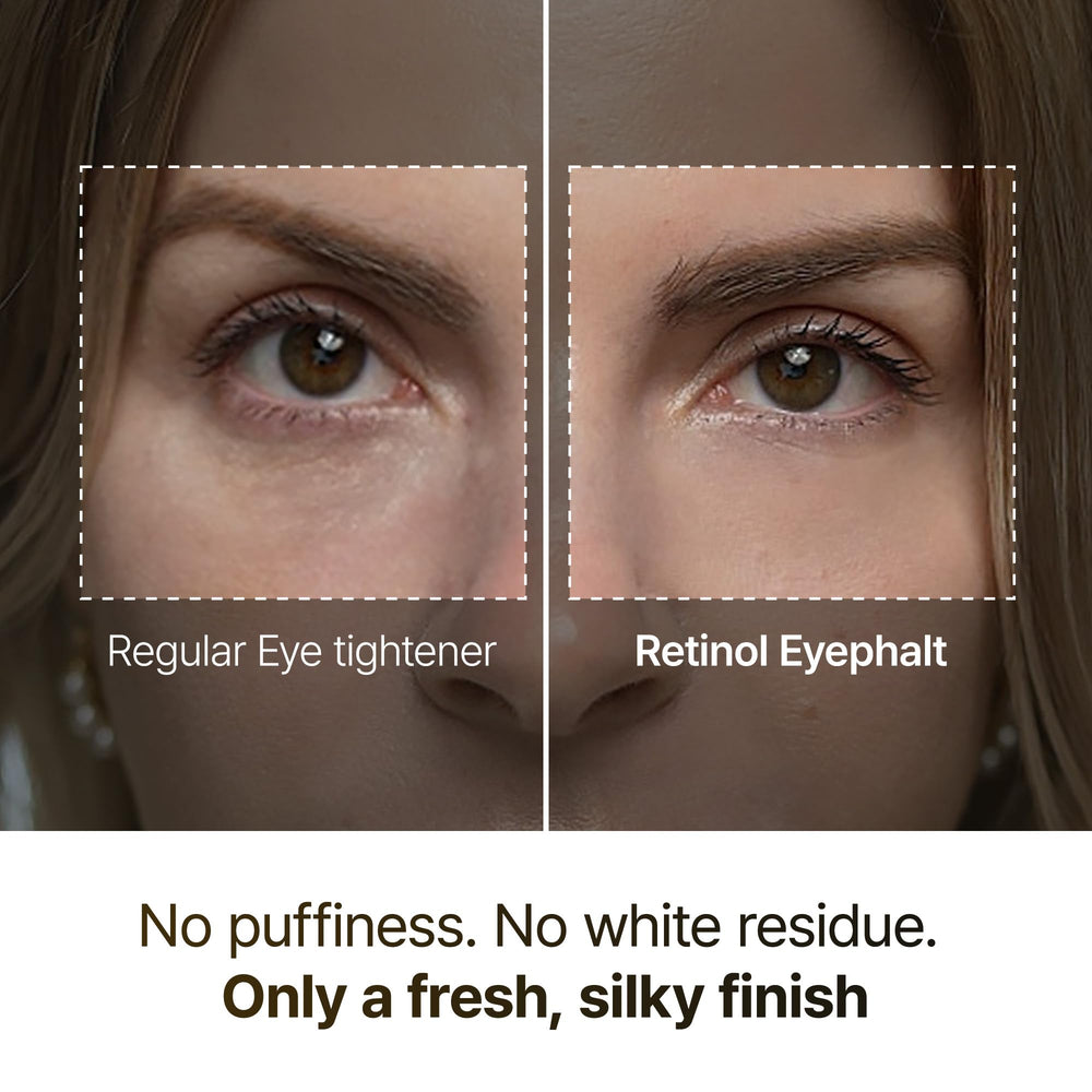 Applying Dr.Melaxin eyebag cream under the eye with gentle patting motion.