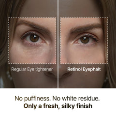 Applying Dr.Melaxin eyebag cream under the eye with gentle patting motion.