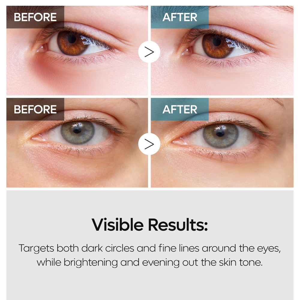 Dual formulation of Dr.Melaxin TX Tranexamic Eye Cream on display
