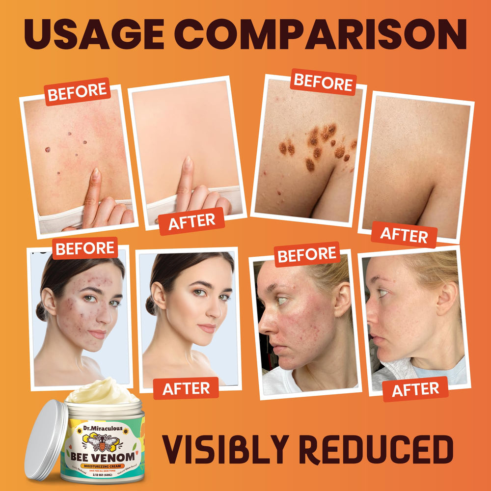 Dr. Miraculous label detail emphasizes natural bee venom and propolis blend.