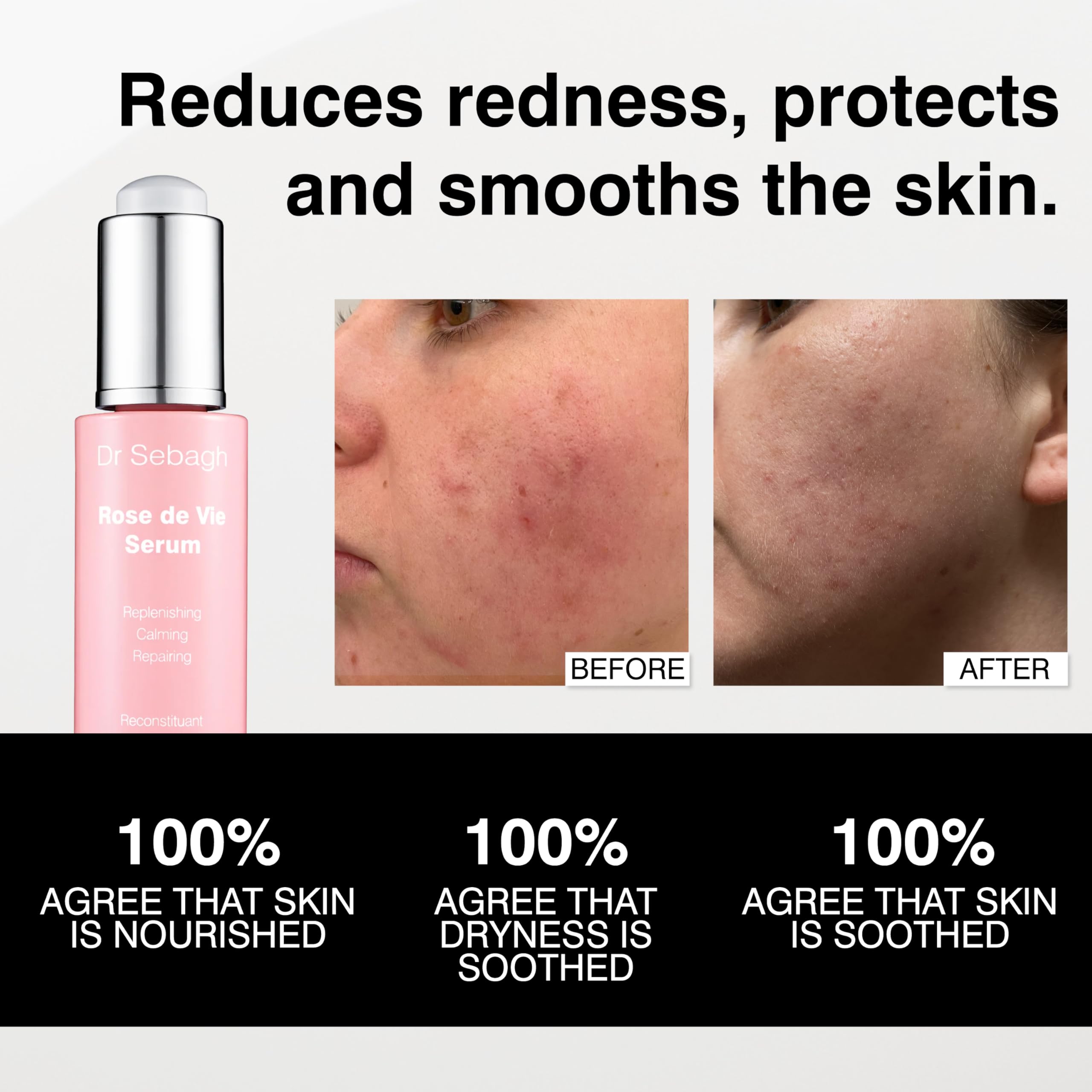 Dr Sebagh Rose de Vie Serum post-treatment recovery support for comfort.