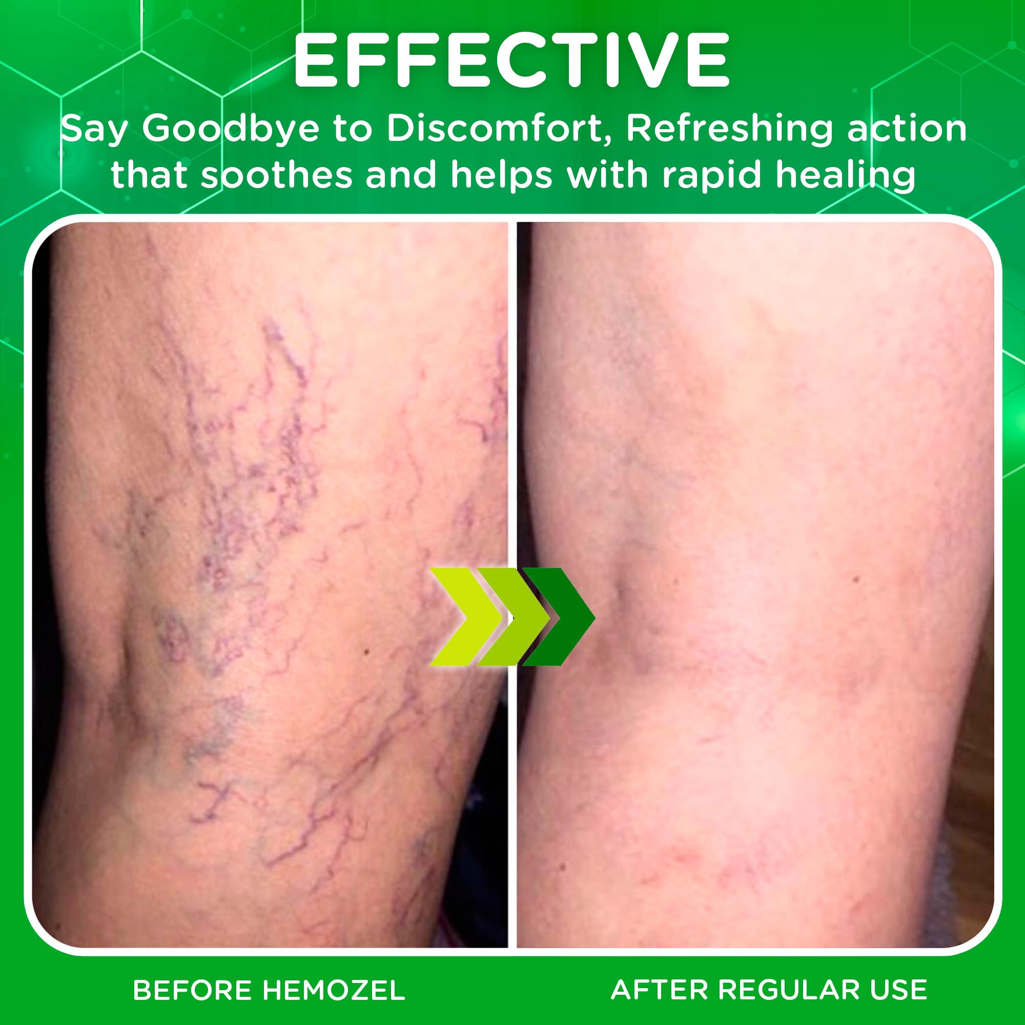 Dr. T HemoZel Cream barrier-support image emphasizing moisture retention.