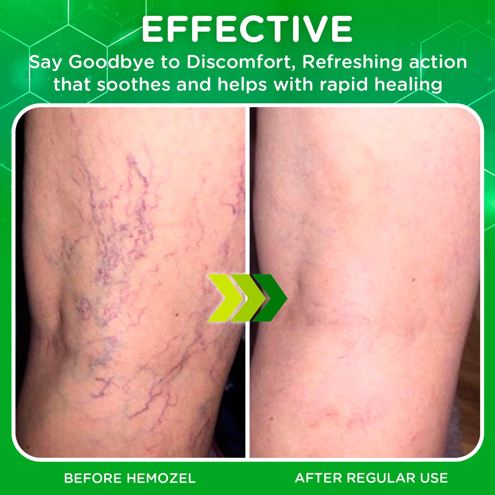 Dr. T HemoZel Cream barrier-support image emphasizing moisture retention.