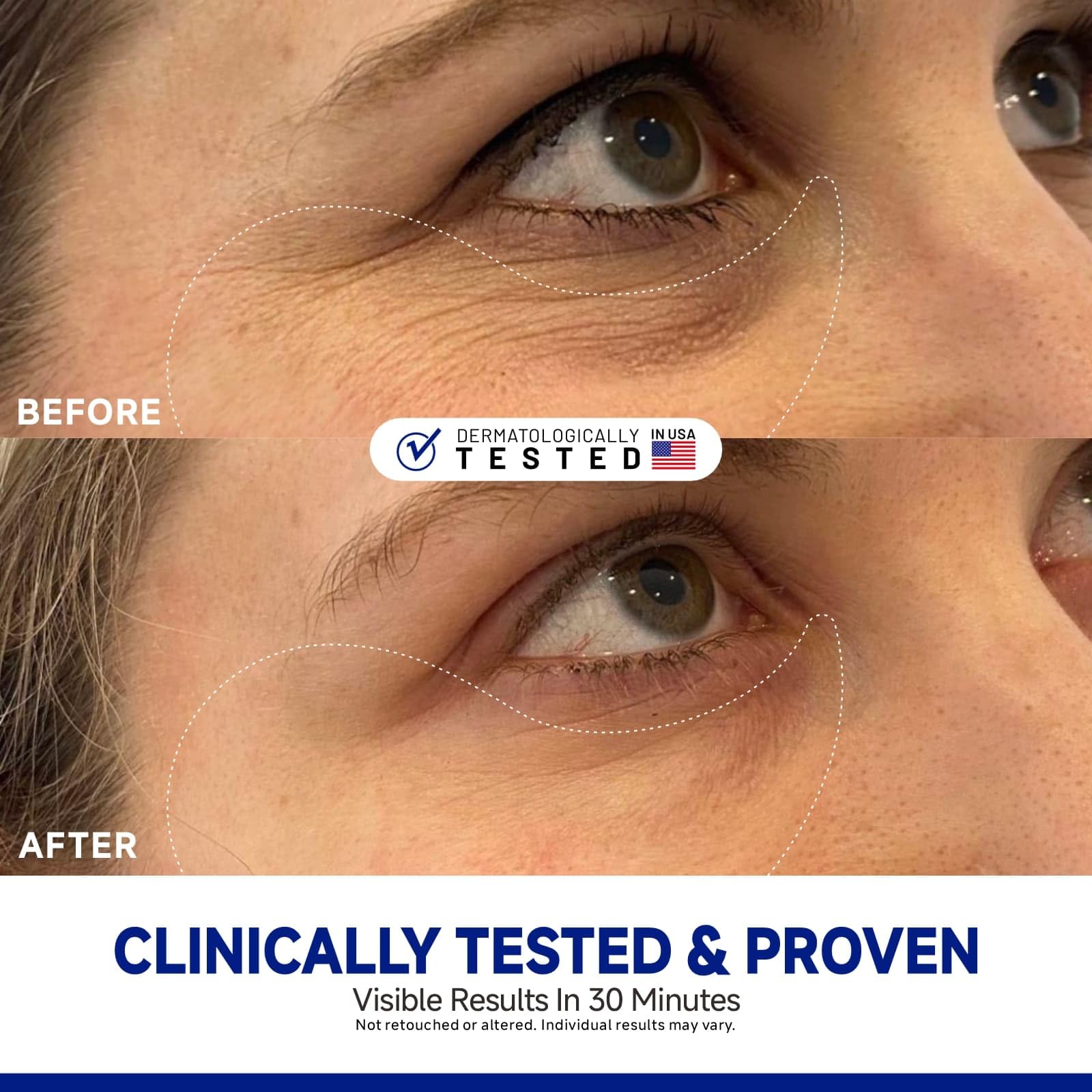 Dr Vincent Cooling Under-Eye Patches apply with a refreshing sensation around the eyes.