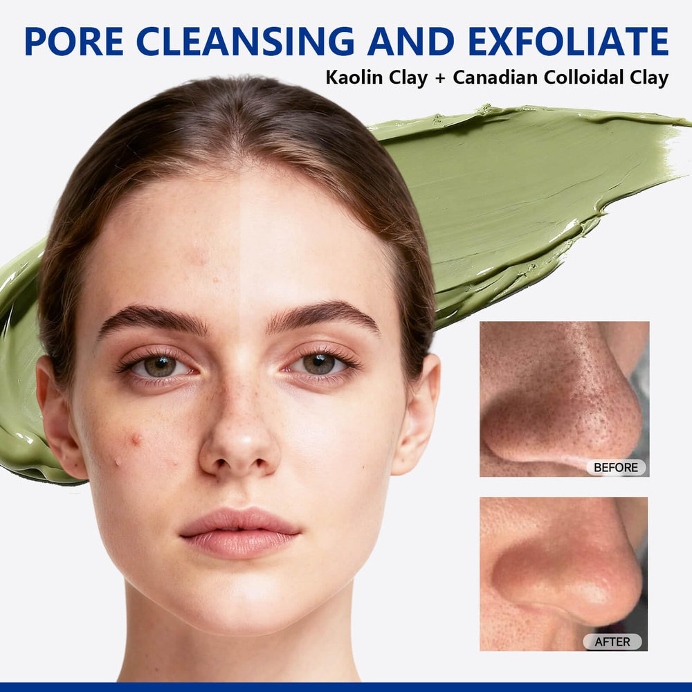 Dr Vincent green clay mask jar with rich mud texture signaling deep cleansing for pores.