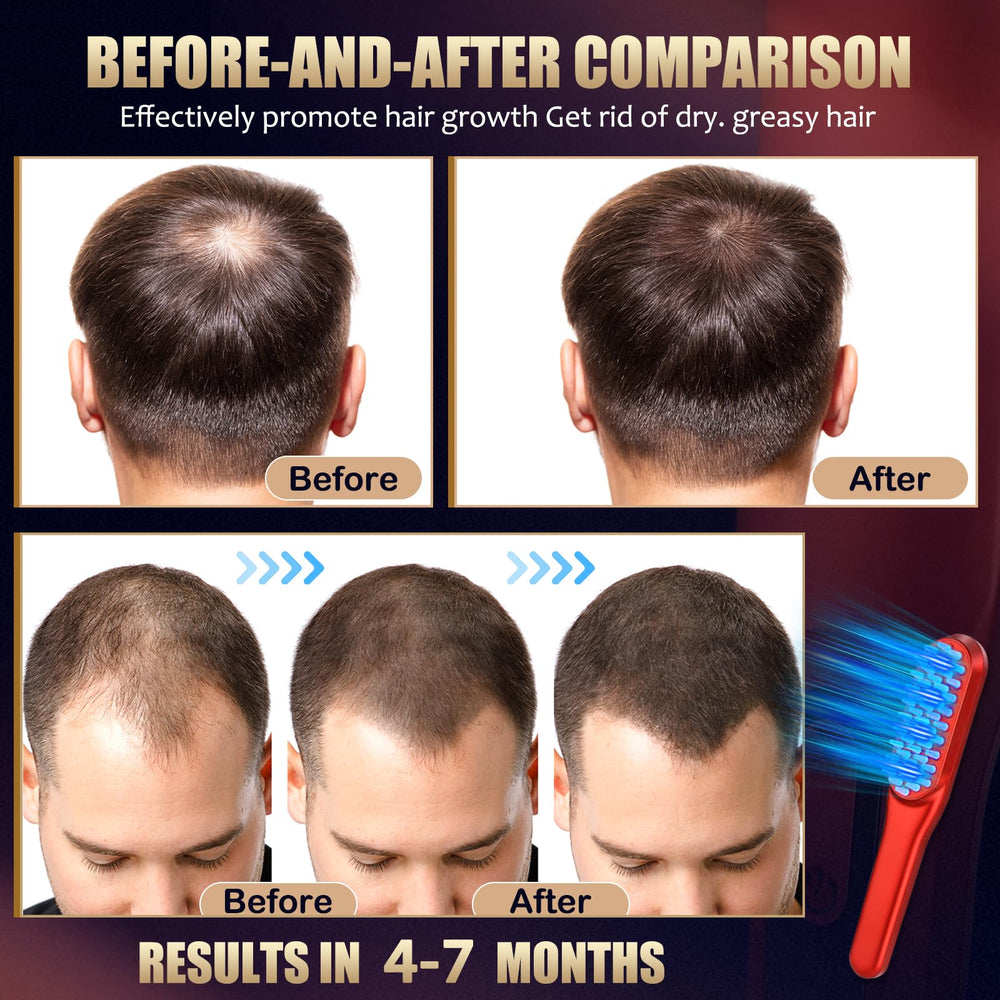 DREWALA Laser Hair Growth Comb complete kit ready for use.
