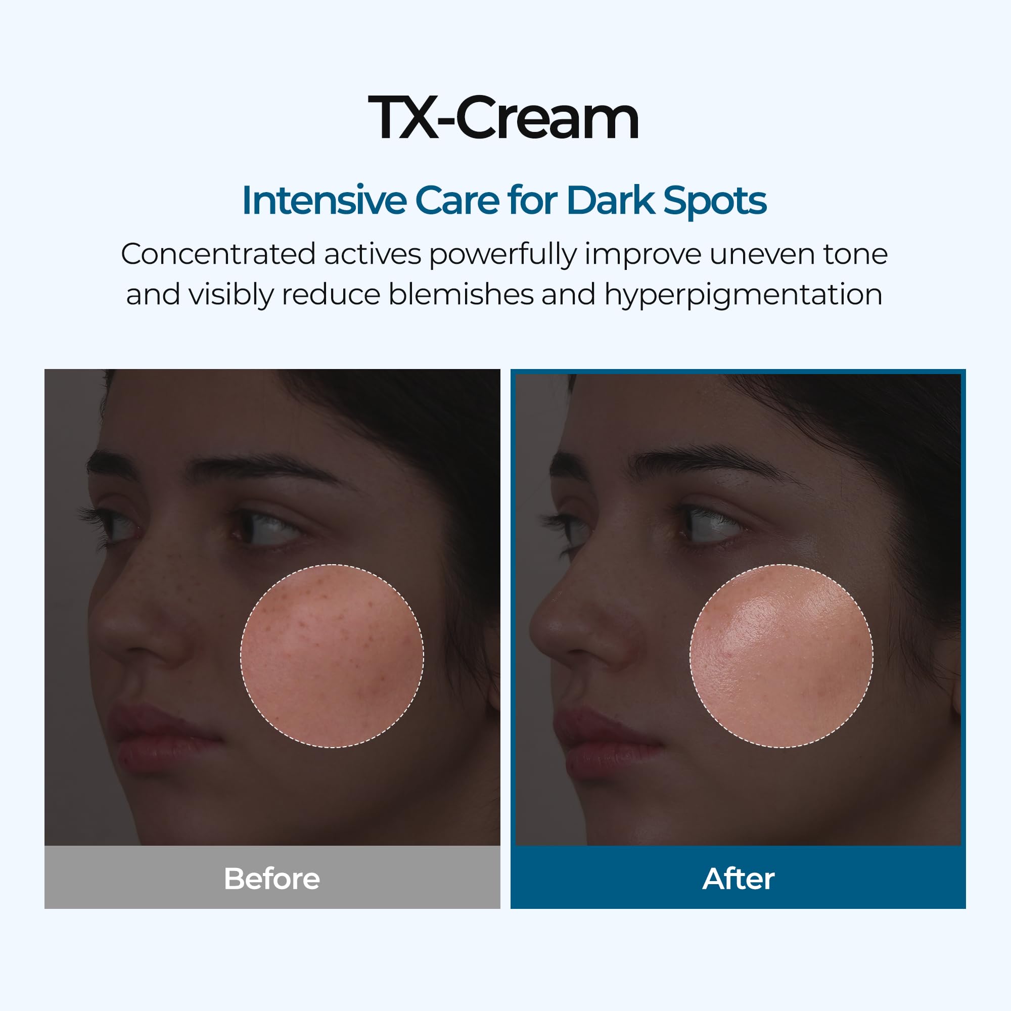 Dr.Melaxin TX Cream texture swirl shows a creamy, hydrating formula.