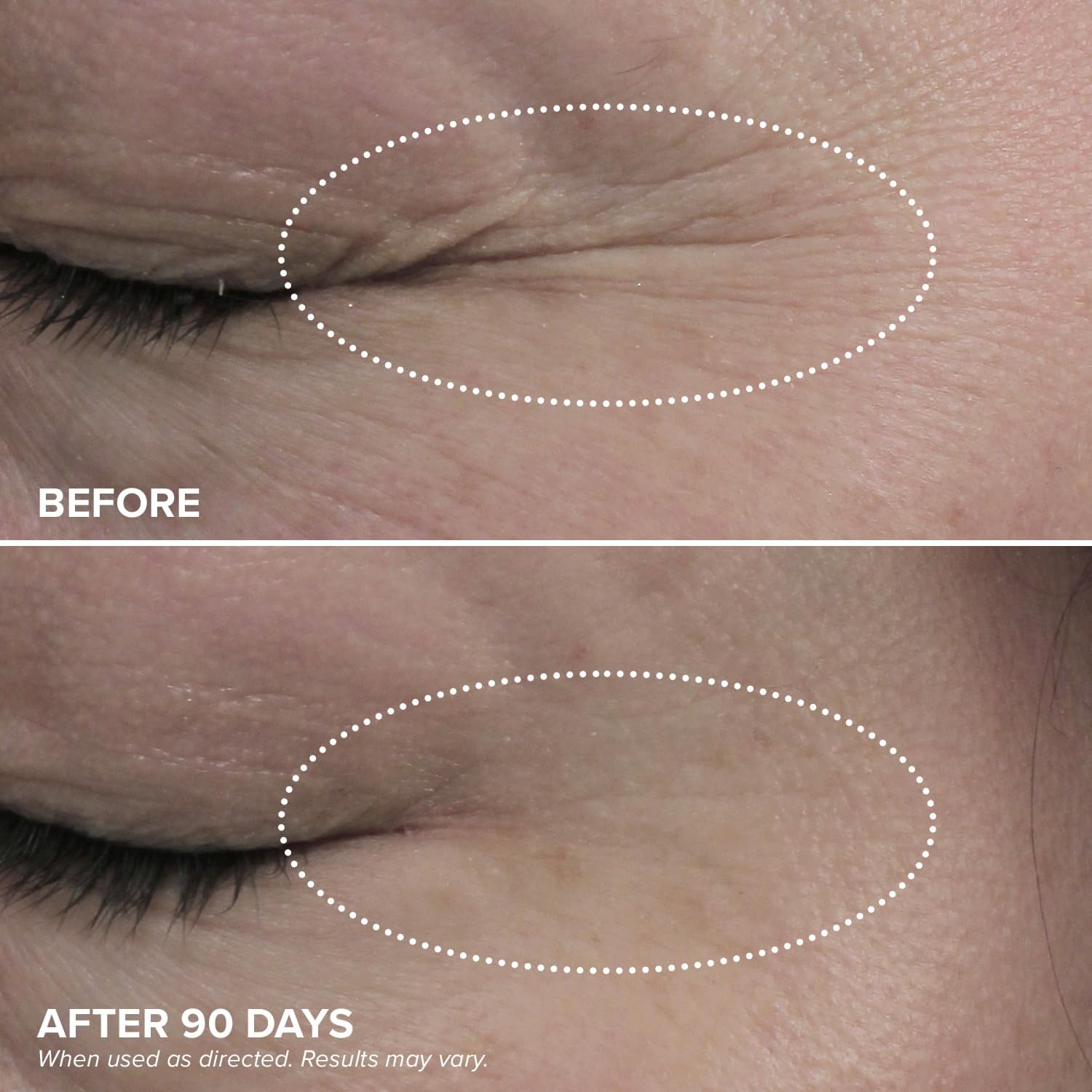 DRMTLGY HPR Eye Cream targets fine lines with gentle performance.