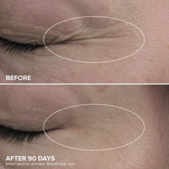 DRMTLGY HPR Eye Cream targets fine lines with gentle performance.