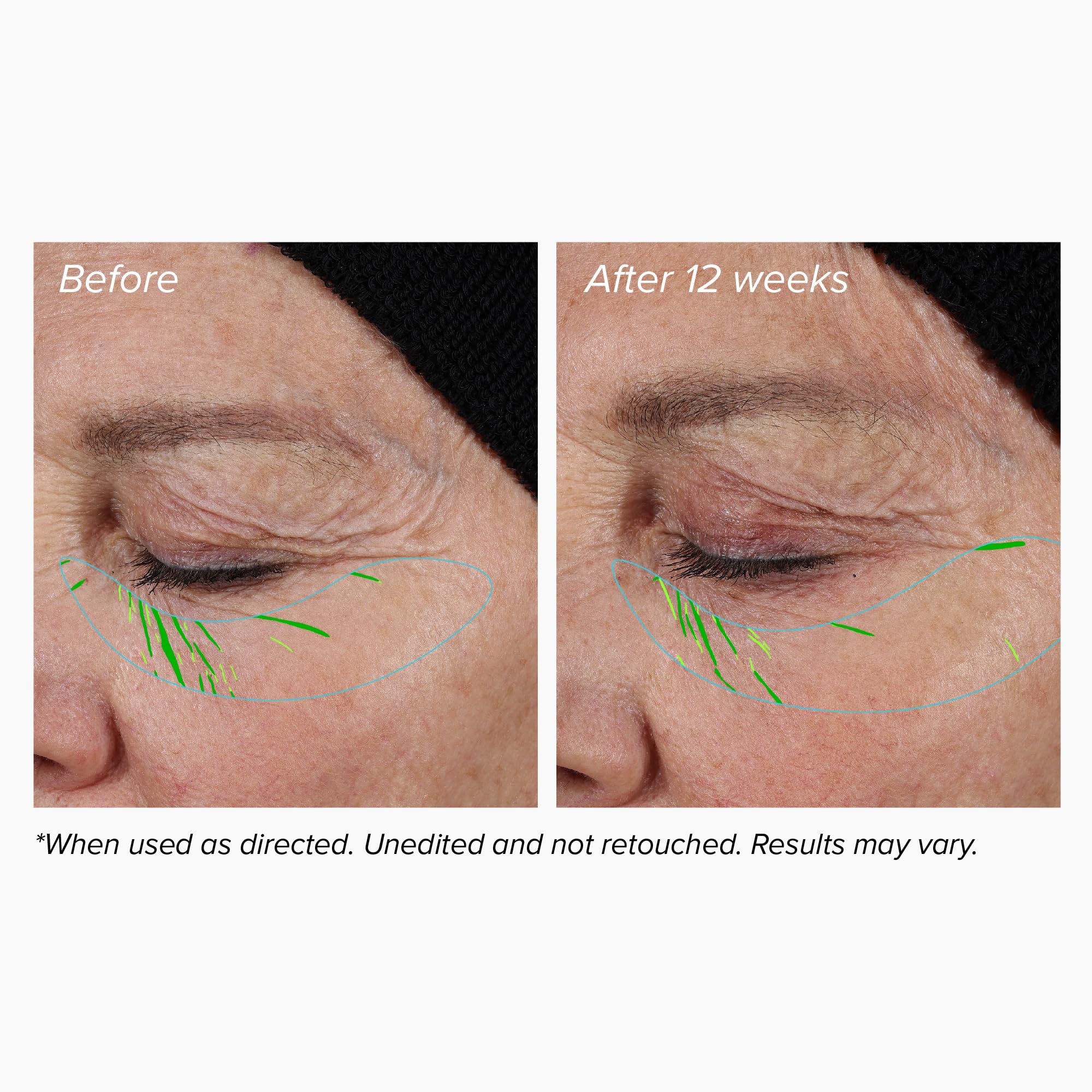 DRMTLGY Sérum facteur croissance visage: absorption rapide sous les soins quotidiens.