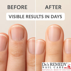 Cuticle oil absorbed around nails for improved moisture