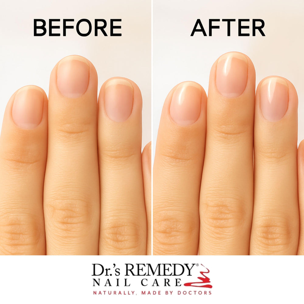 Dr.'s Remedy Therapeutic Cuticle Oil bottle detail emphasizes nourishment