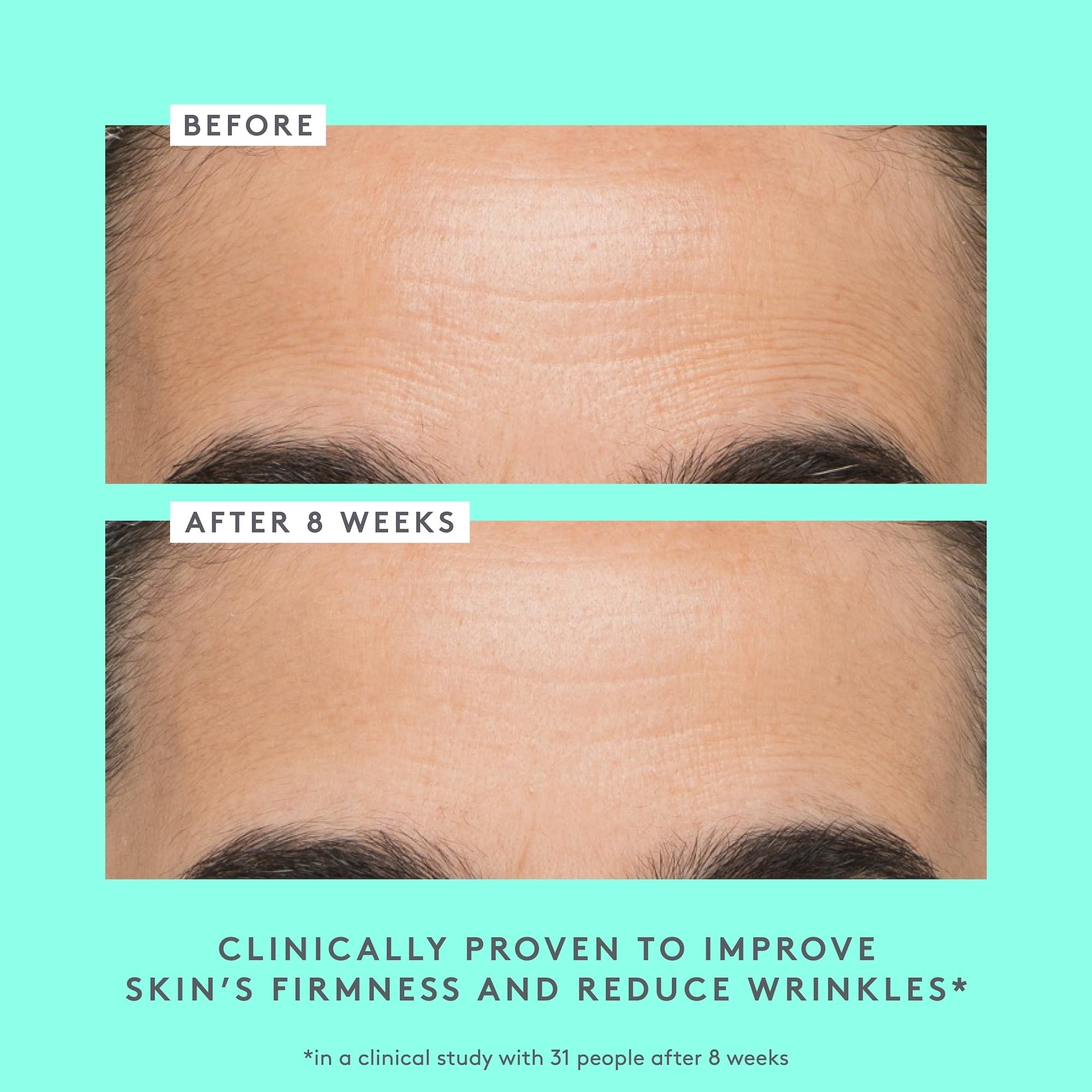 Applying Protini on clean skin demonstrates daily use and absorption.