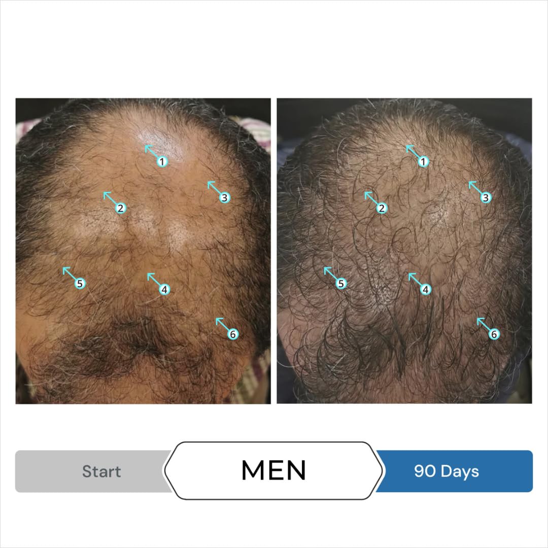DS Laboratories Hair Regrowth Kit packaging shot highlighting two-product regimen