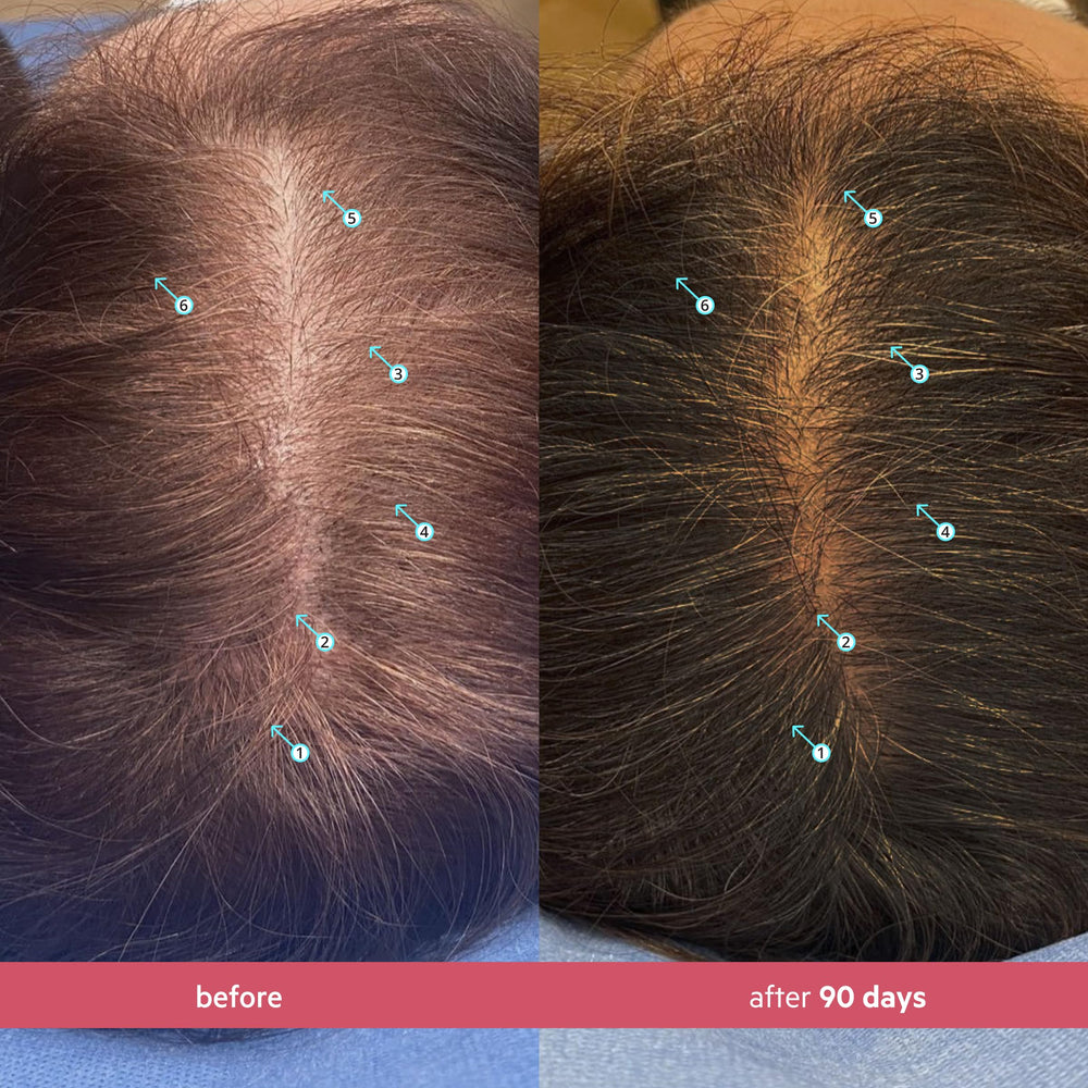 DS Laboratories Spectral Women’s Hair Density Serum applied to scalp showing fast absorption