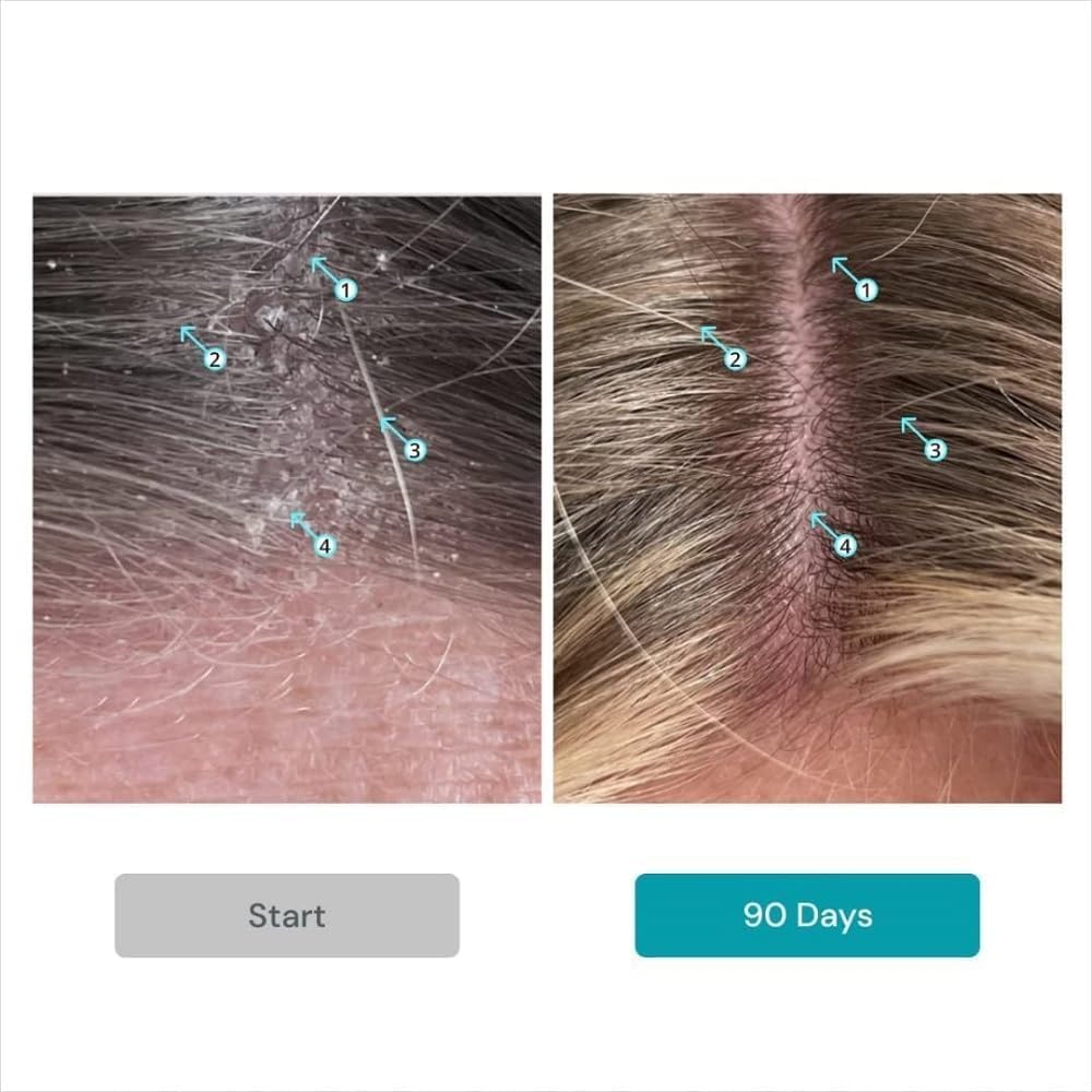 DS Labs Dandrene exfoliating shampoo action with lather for scalp care.