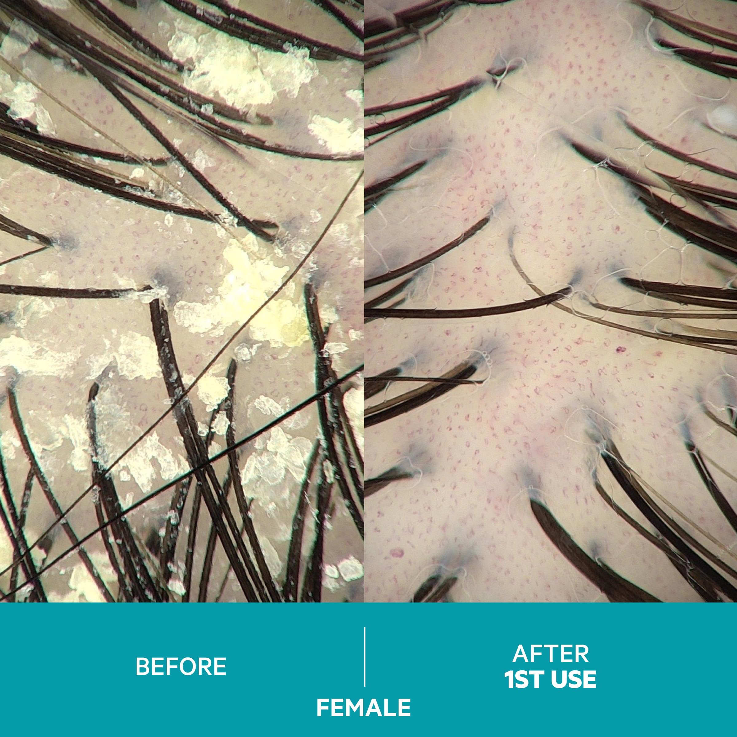 DS Labs Dandrene lather close-up showcasing cleansing action on scalp