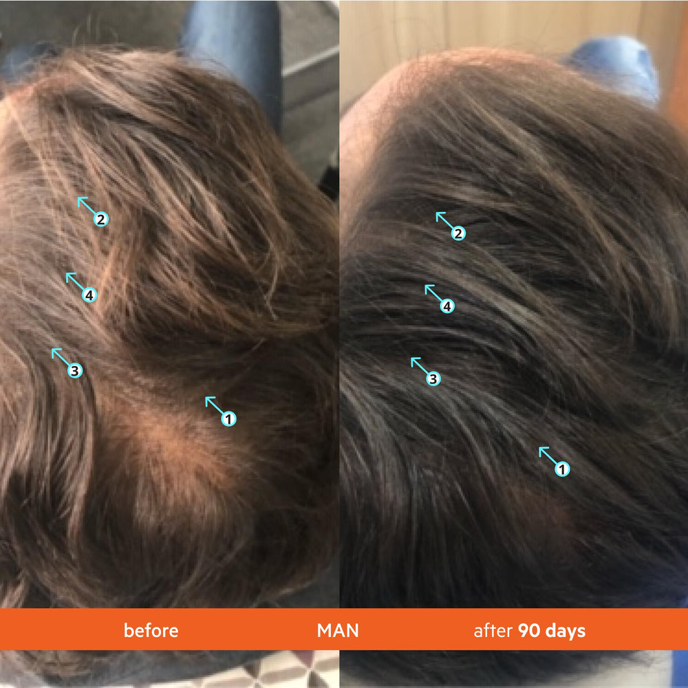 DS Laboratories Revita shampoo closeup focuses on clean scalp and vitality.