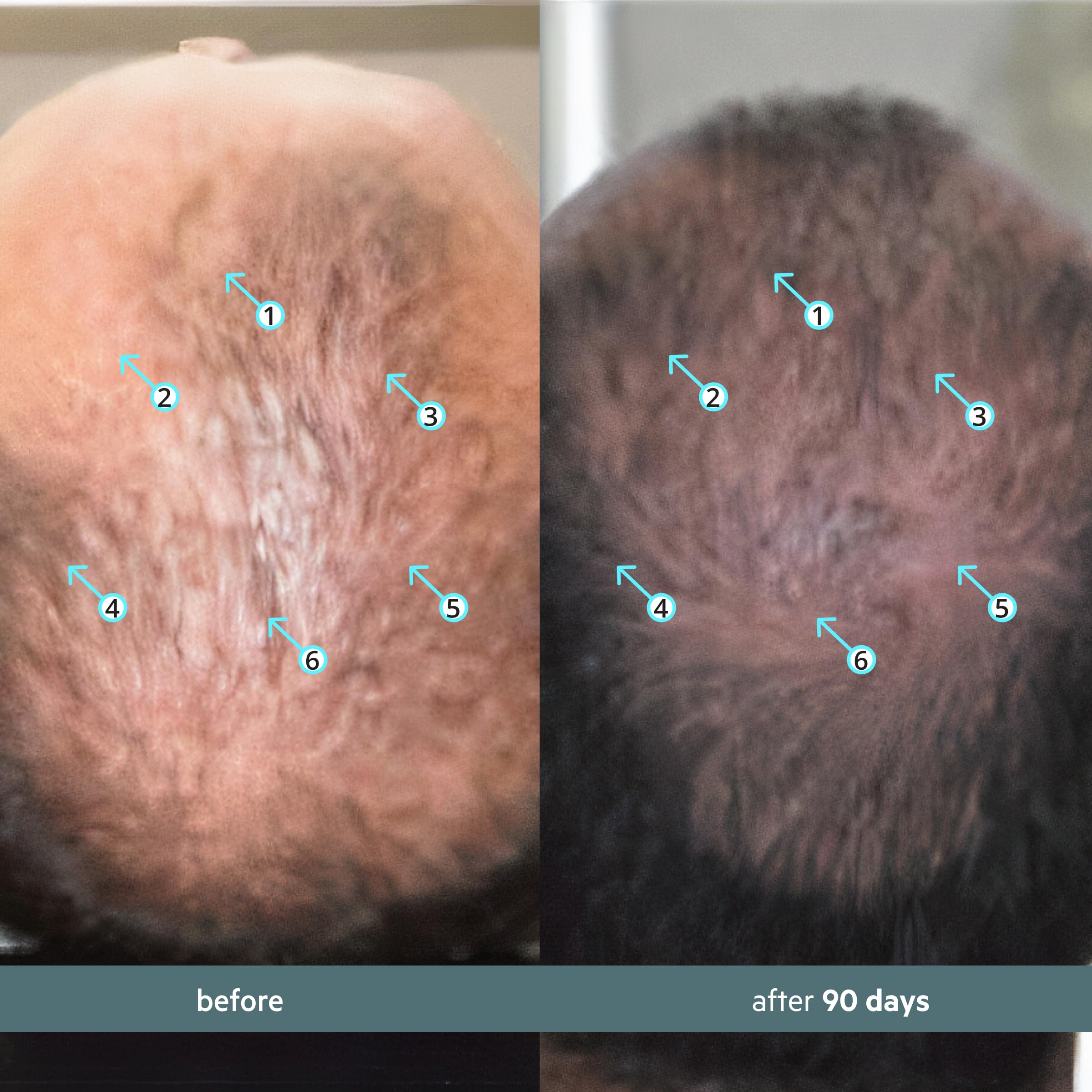 DS Labs Spectral Booster applied during daily routine for refreshed scalp.