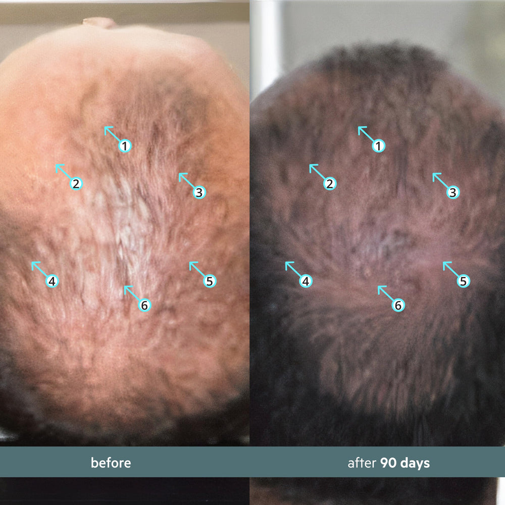 DS Labs Spectral Booster applied during daily routine for refreshed scalp.