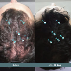 DS Labs Spectral Booster scalp application demonstrating targeted density look.
