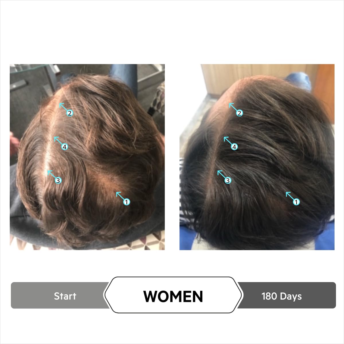 DS Laboratories Spectral serum-close-up of hair roots emphasizes density appearance