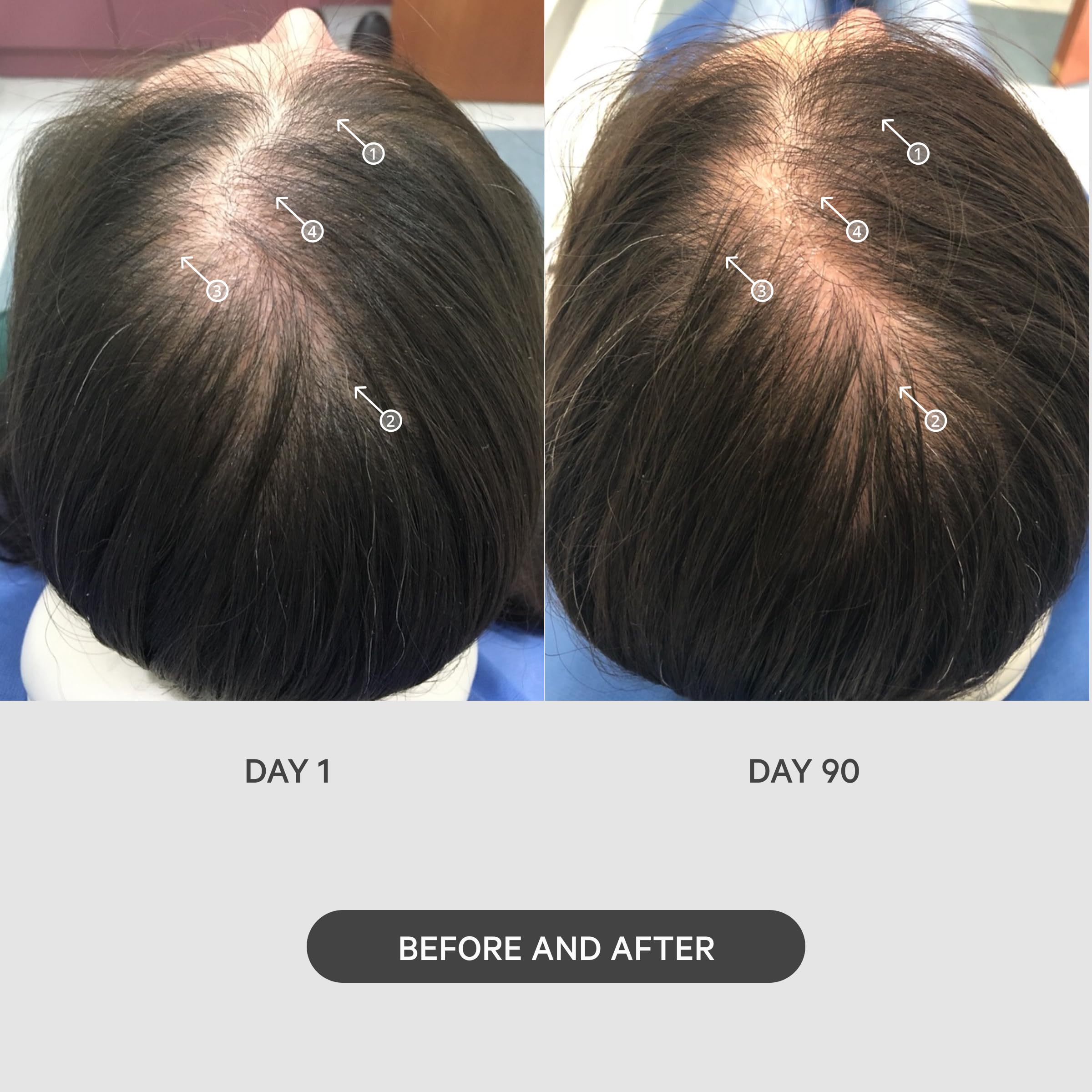 DS Labs StimuROLLER enhances absorption of serums and oils for scalp care.