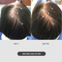 DS Labs StimuROLLER enhances absorption of serums and oils for scalp care.