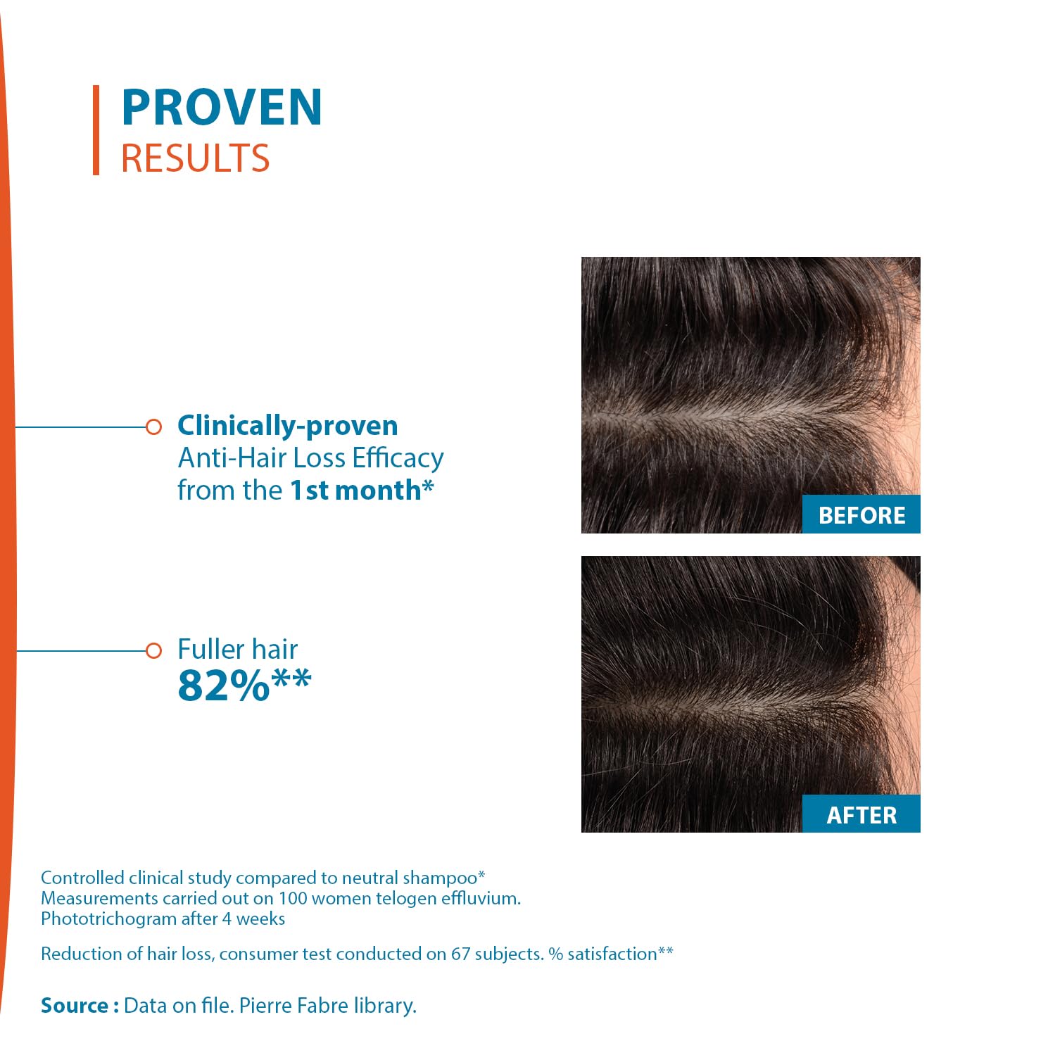 Creastim Reactiv bottle dispensing pump illustrating easy daily scalp application