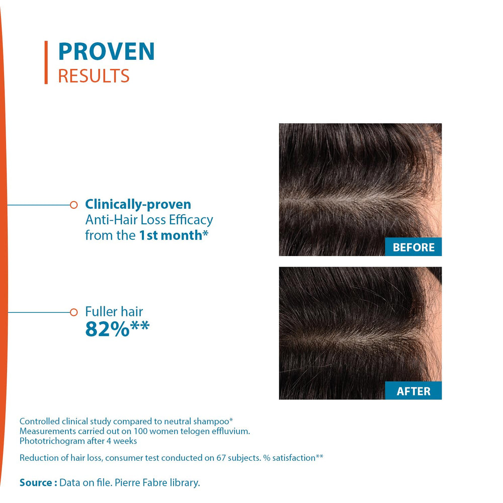 Creastim Reactiv bottle dispensing pump illustrating easy daily scalp application