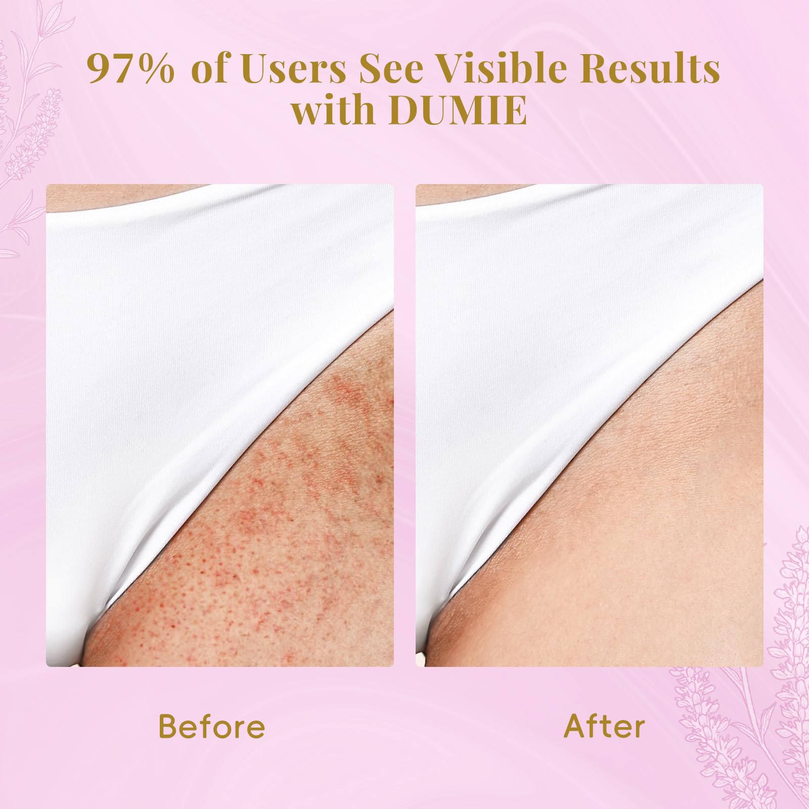 Dumie fragrance-free formula supporting sensitive skin during post-removal care