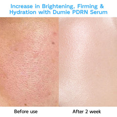 Dumie serum being applied to skin to illustrate quick absorption and smooth texture