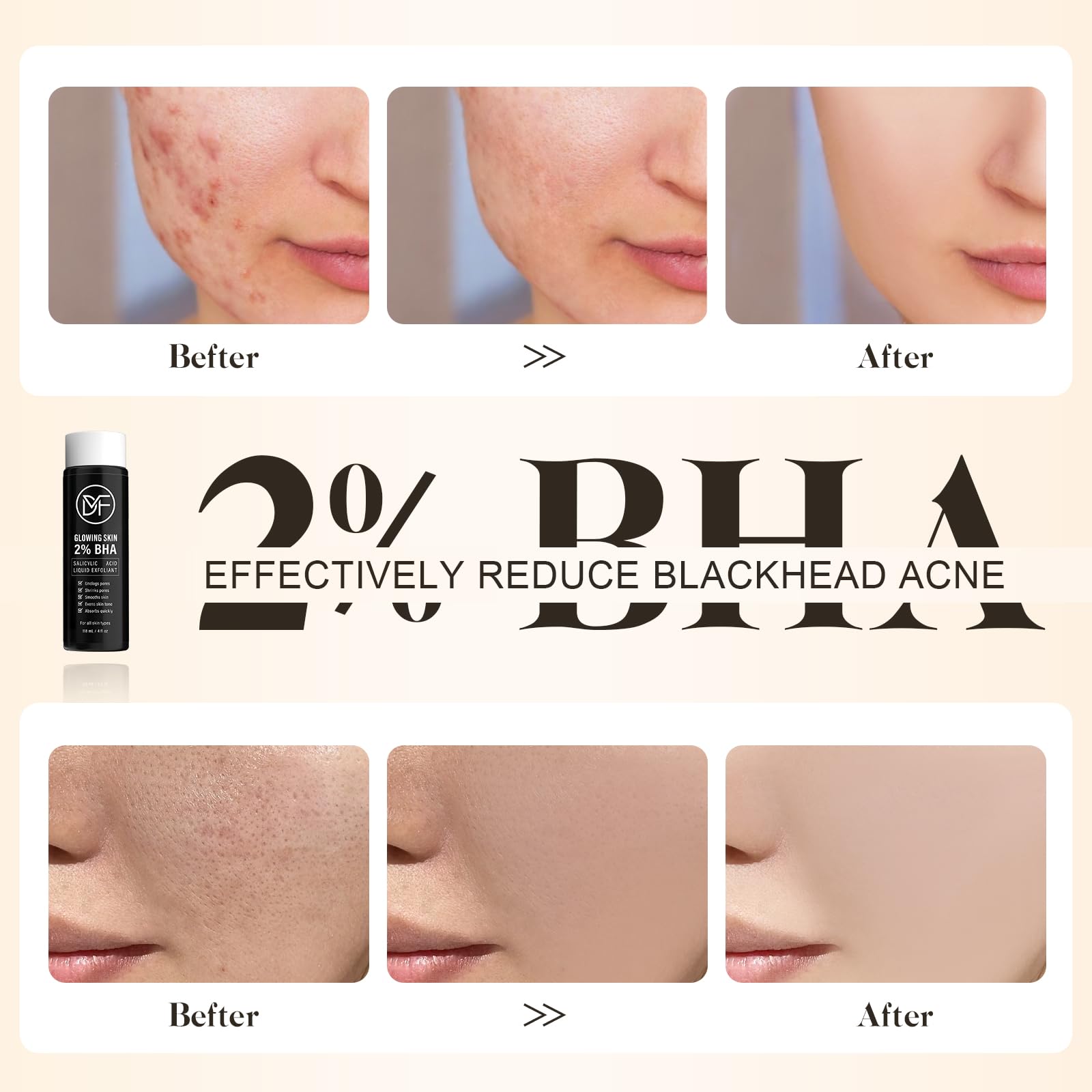 DuralineMakeupFixer 2% BHA texture close-up highlights lightweight formula