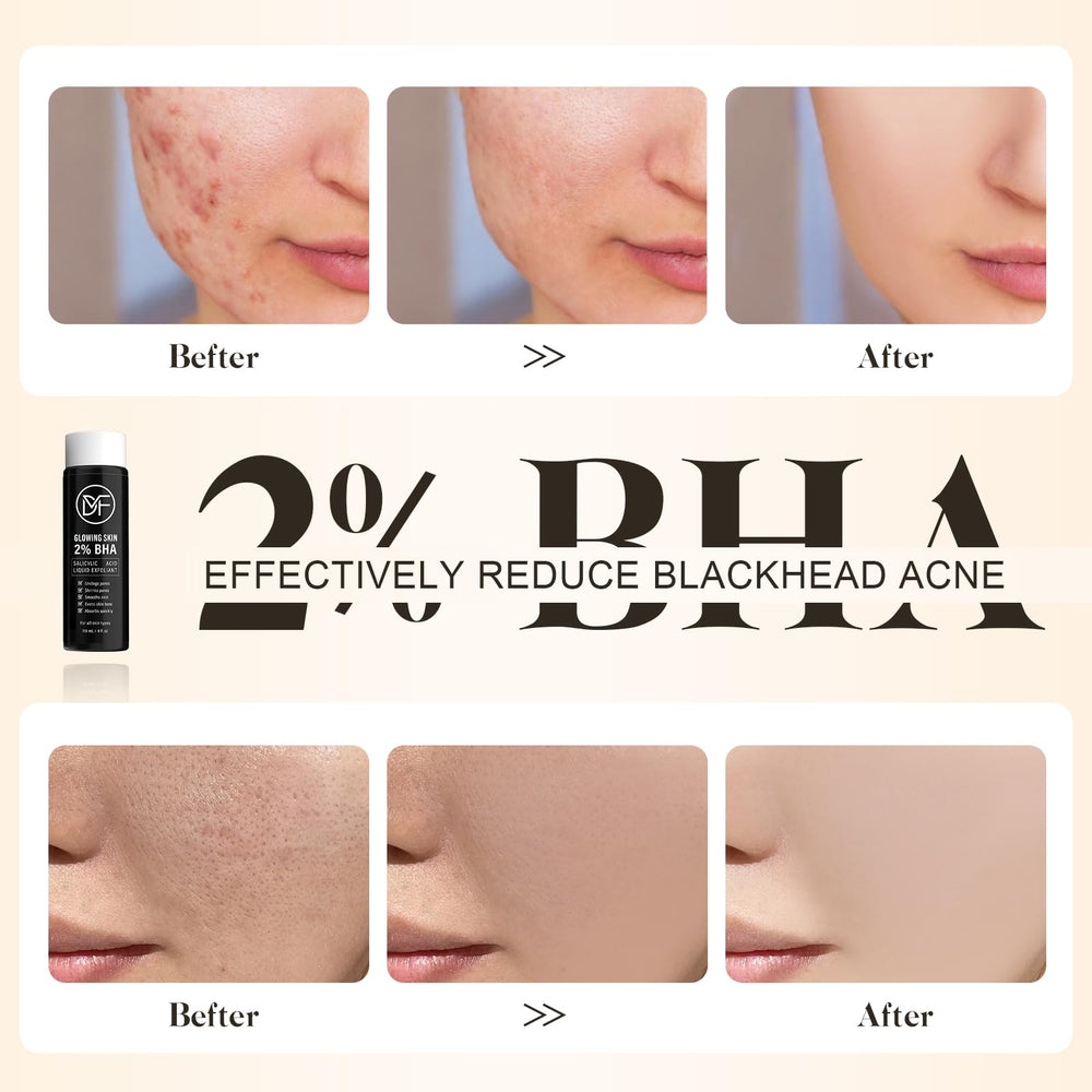 DuralineMakeupFixer 2% BHA texture close-up highlights lightweight formula