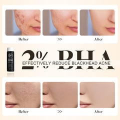 DuralineMakeupFixer 2% BHA texture close-up highlights lightweight formula