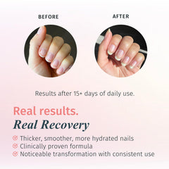 Duri Rejuvacote 1 nails closeup reveals smoother, reinforced nail edges.