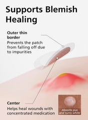 DWEasyDerm tea tree oil patch with BHA targets blemishes under makeup.