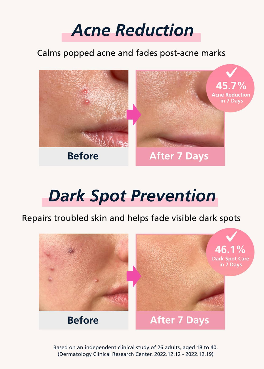 DWEasyDerm hyaluronic acid hydrates skin while wearing the patch.