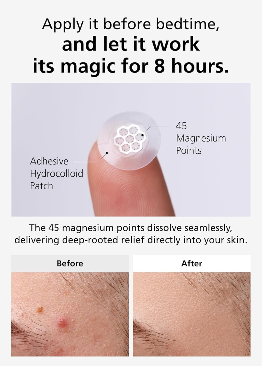 Pharmaceutical-quality label from Daewoong on EasyDerm patches.